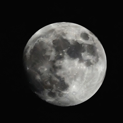Patient reviewing pre-operative instructions with a medical professional